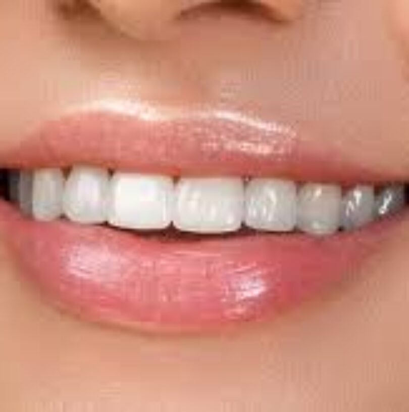 blog - Cheadle Hulme Dental
