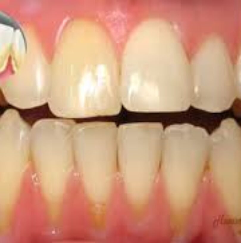 blog - Cheadle Hulme Dental