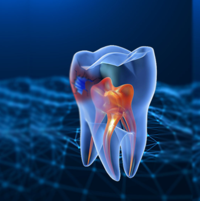 blog - Cheadle Hulme Dental
