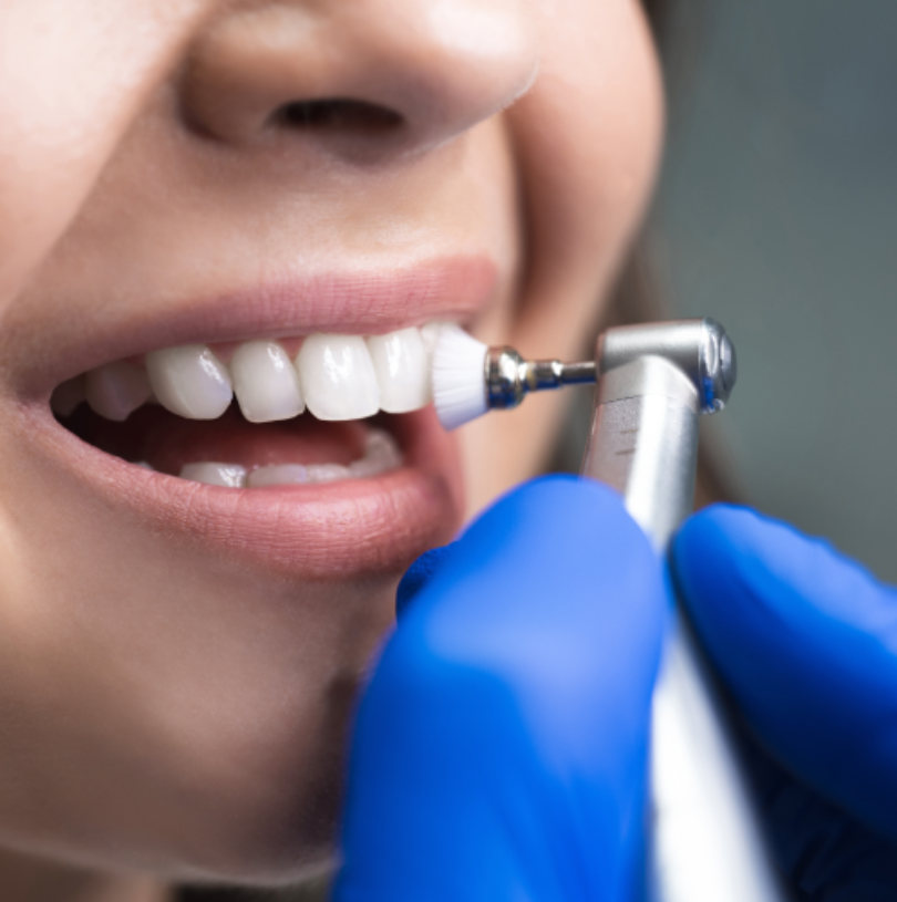 blog - Cheadle Hulme Dental