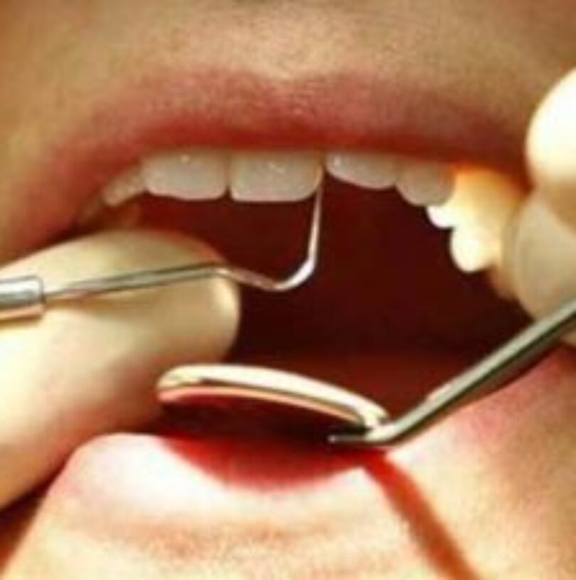 blog - Cheadle Hulme Dental