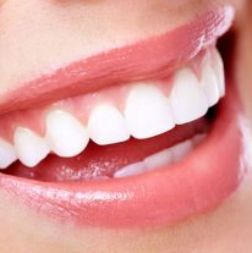 blog - Cheadle Hulme Dental
