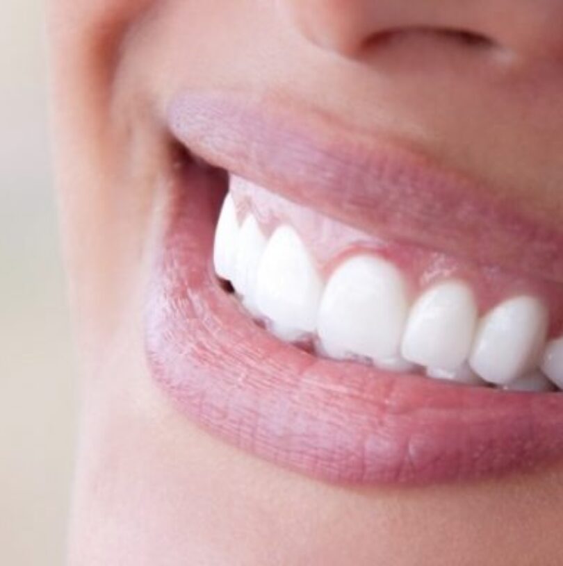 blog - Cheadle Hulme Dental