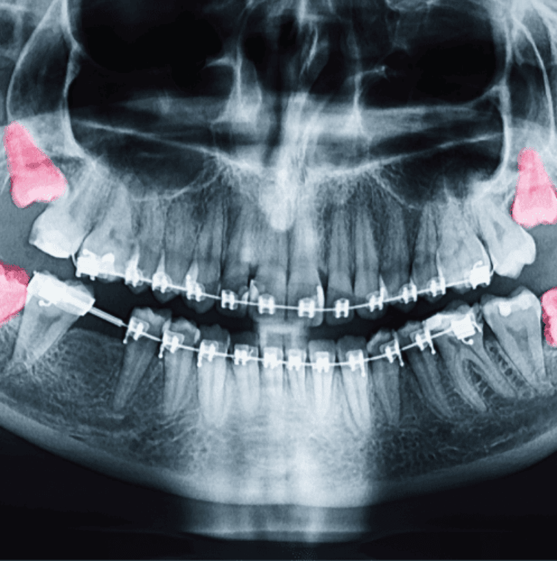 blog - Cheadle Hulme Dental
