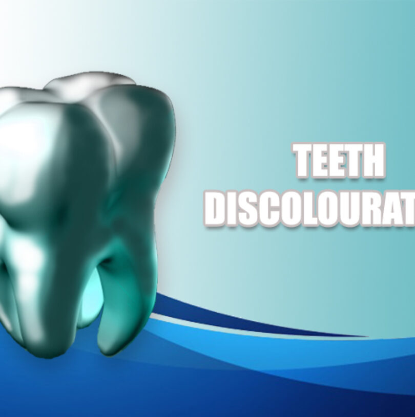 blog - Cheadle Hulme Dental