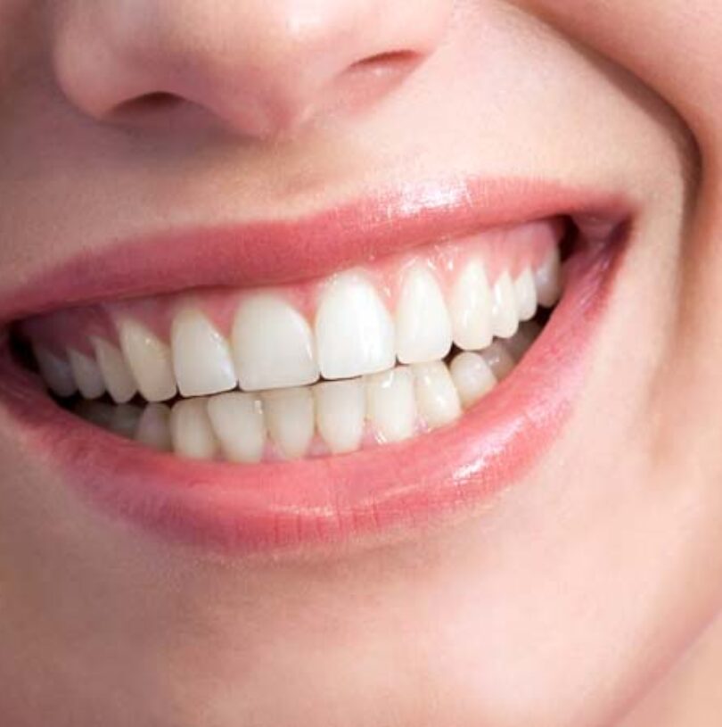 blog - Cheadle Hulme Dental