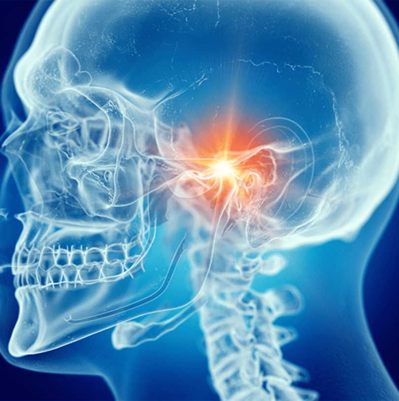 blog - Cheadle Hulme Dental