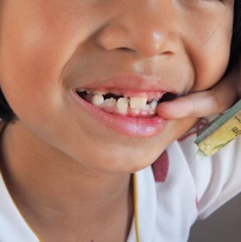 blog - Cheadle Hulme Dental