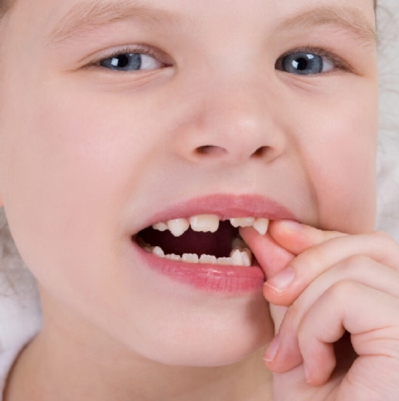 blog - Cheadle Hulme Dental