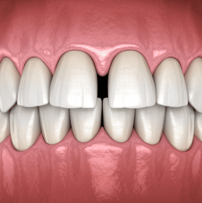 blog - Cheadle Hulme Dental