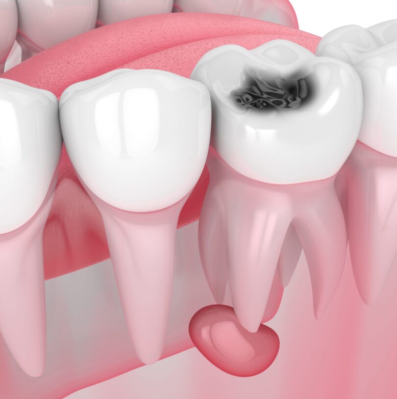 blog - Cheadle Hulme Dental