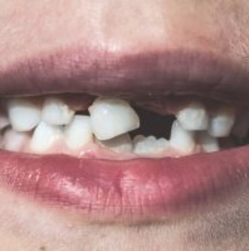 blog - Cheadle Hulme Dental