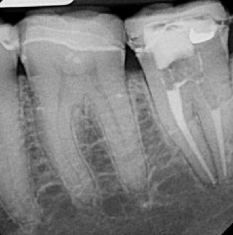 blog - Cheadle Hulme Dental