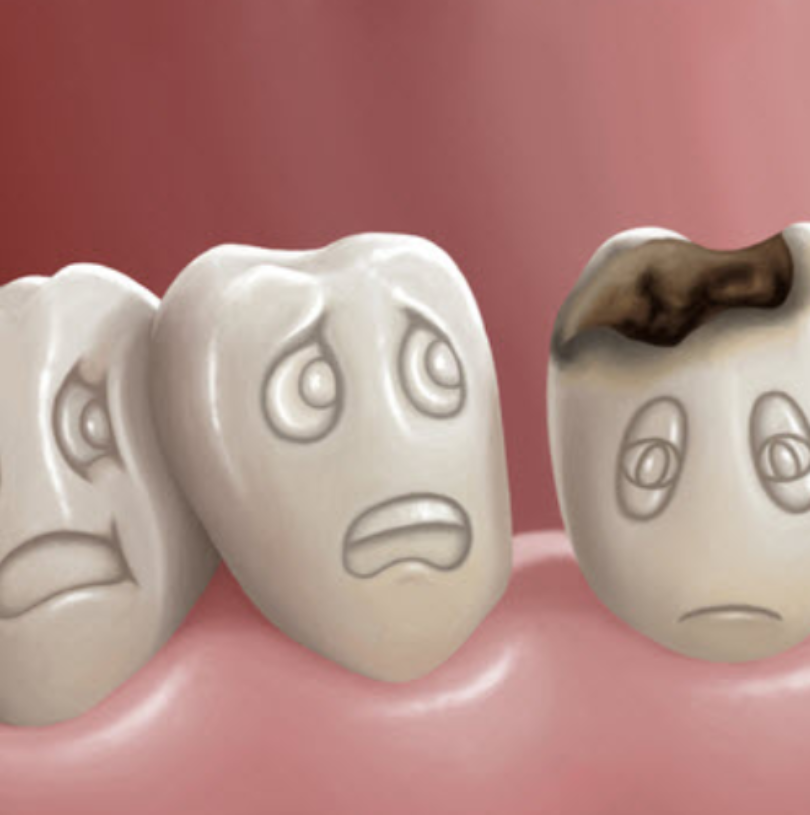 blog - Cheadle Hulme Dental