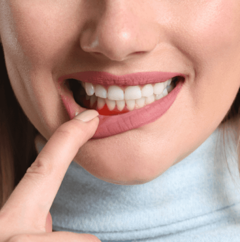 blog - Cheadle Hulme Dental