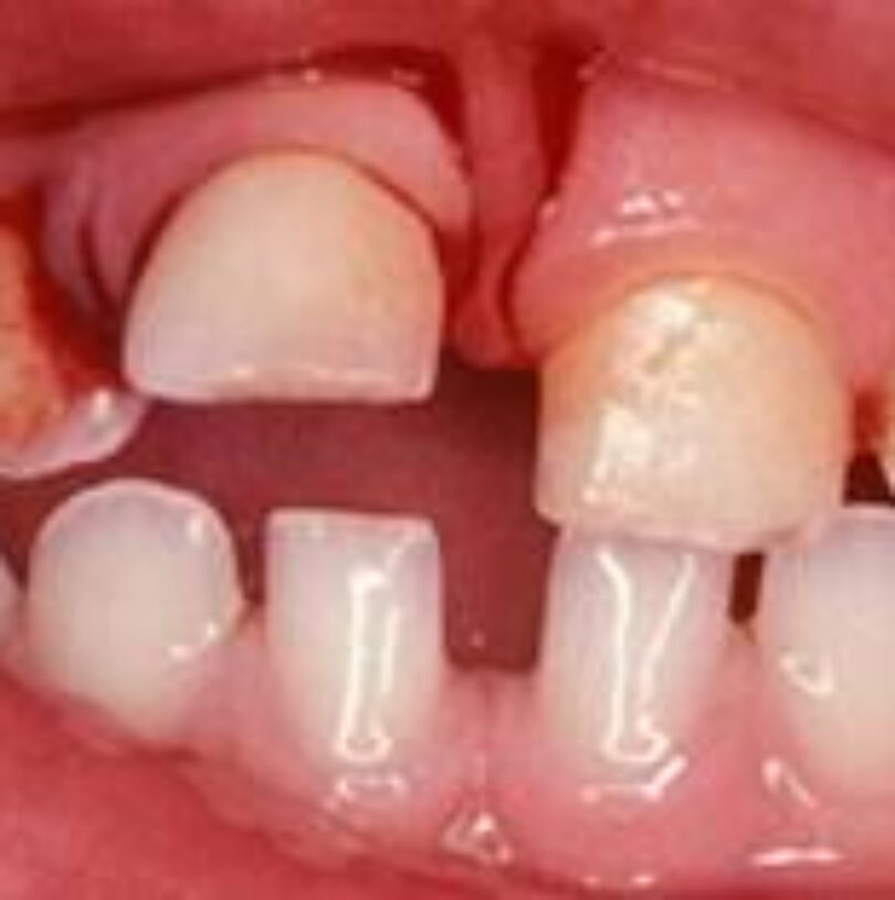 blog - Cheadle Hulme Dental