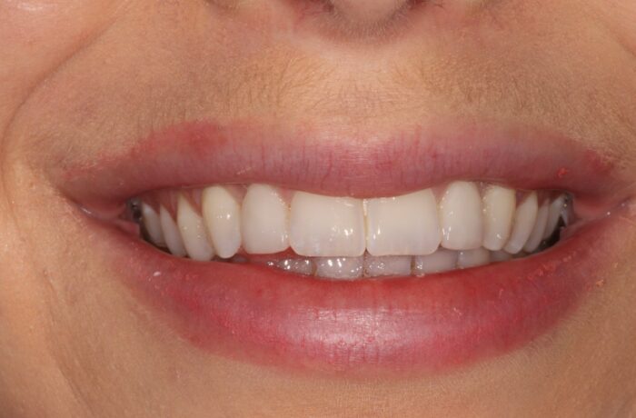 After - Cheadle Hulme Dental