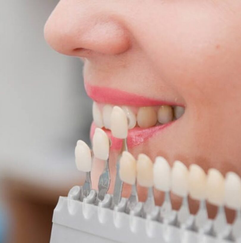 blog - Cheadle Hulme Dental