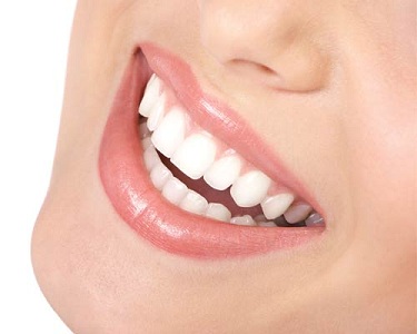 white-smile1