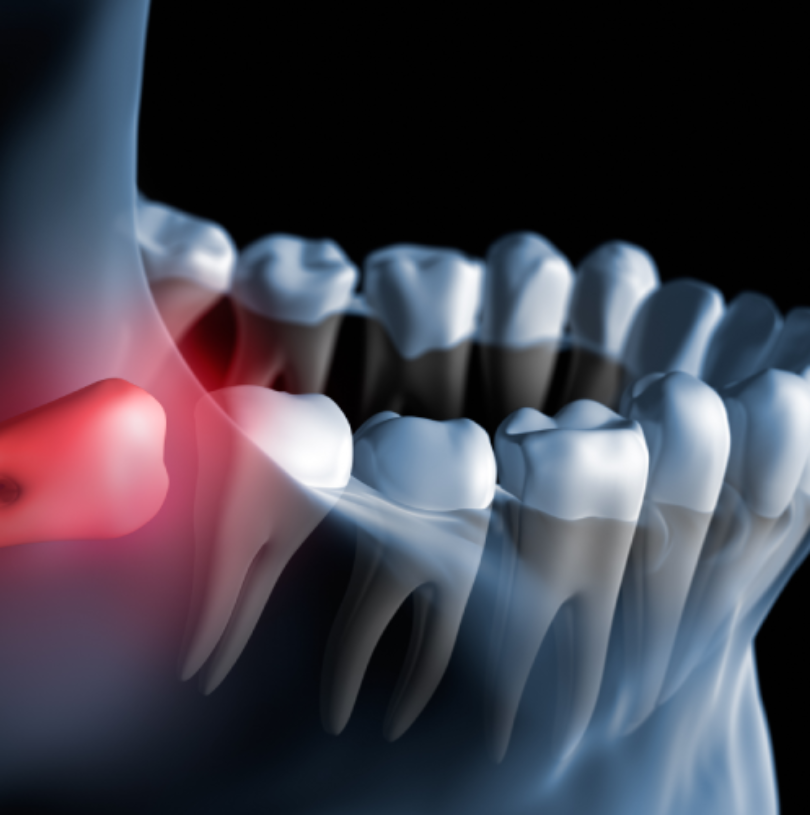 blog - Cheadle Hulme Dental