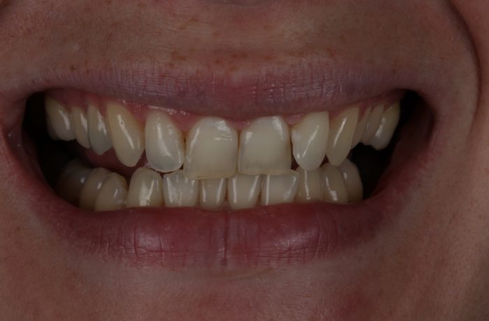 Before - Cheadle Hulme Dental