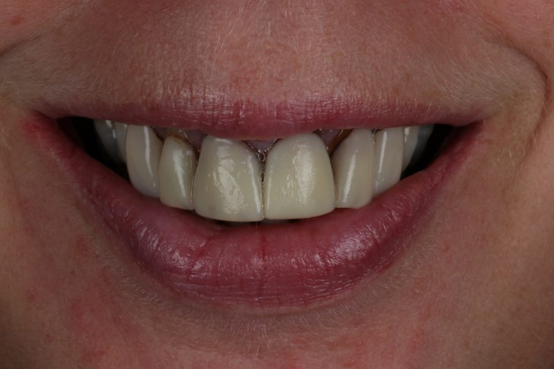 Before - Cheadle Hulme Dental