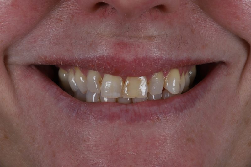 Before - Cheadle Hulme Dental