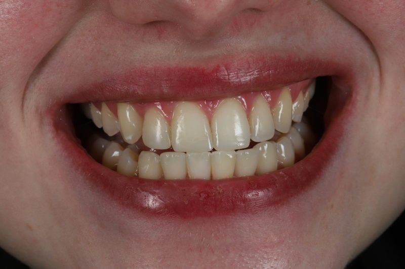 After - Cheadle Hulme Dental