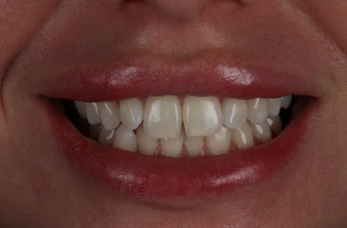 Before - Cheadle Hulme Dental