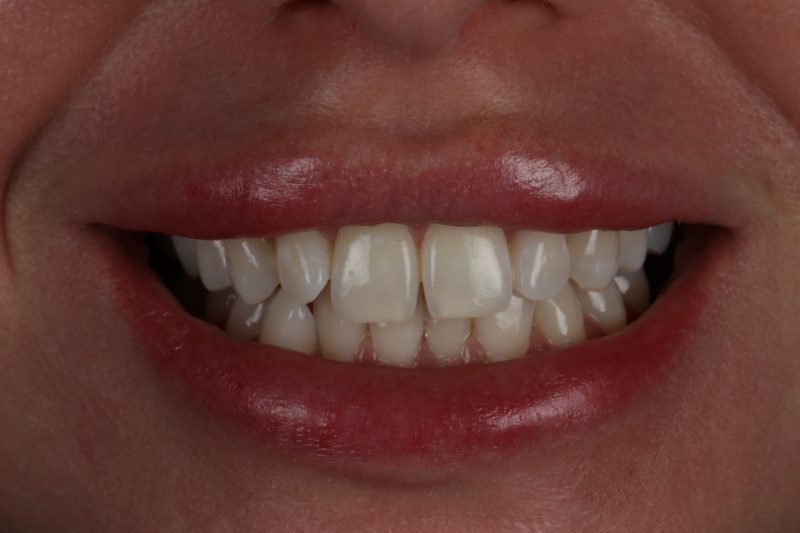 Before - Cheadle Hulme Dental