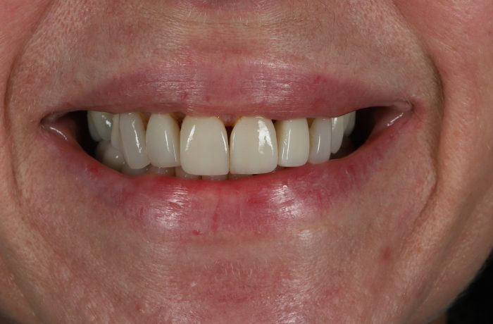 Before - Cheadle Hulme Dental