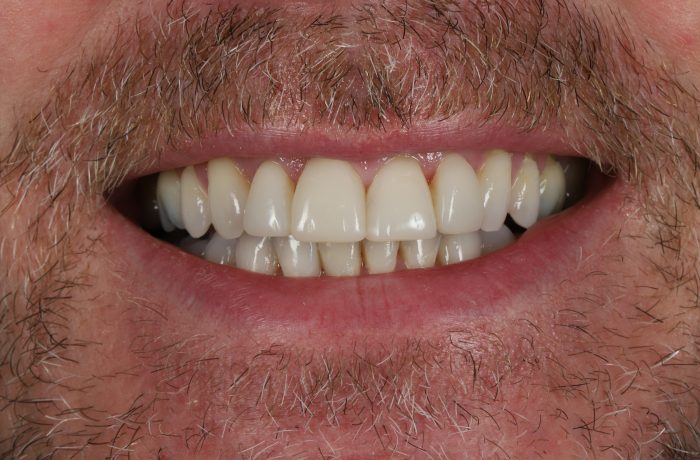 After - Cheadle Hulme Dental
