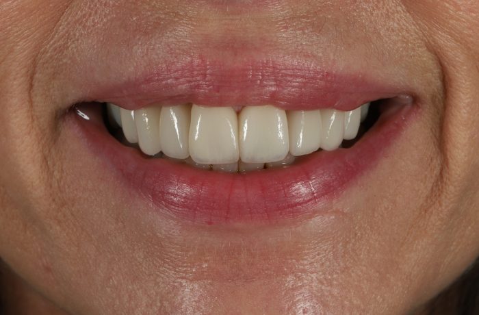 After - Cheadle Hulme Dental
