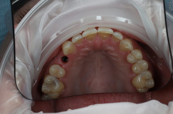 After - Cheadle Hulme Dental