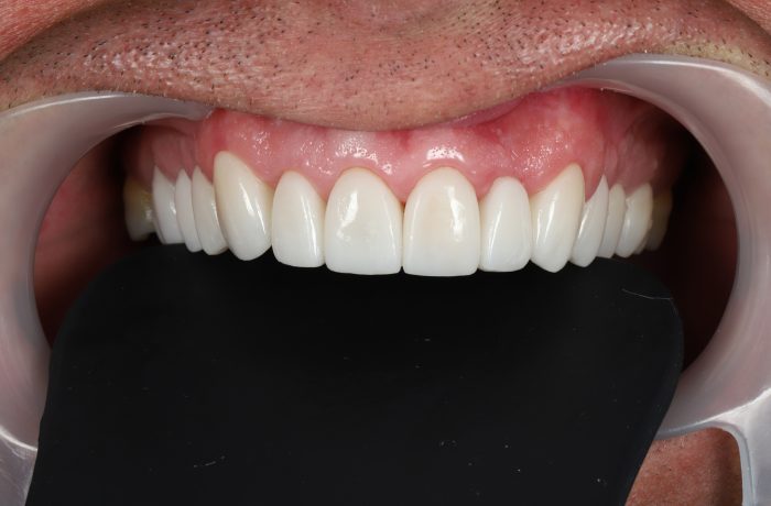 After - Cheadle Hulme Dental