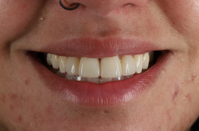 After - Cheadle Hulme Dental