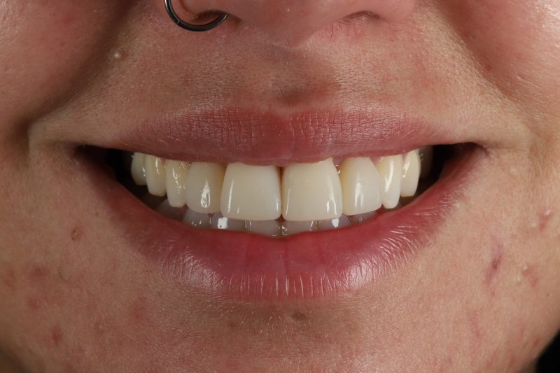 After - Cheadle Hulme Dental