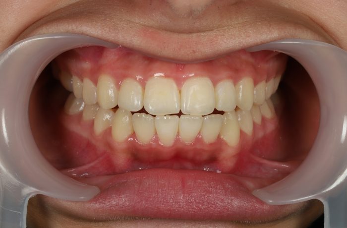 After - Cheadle Hulme Dental