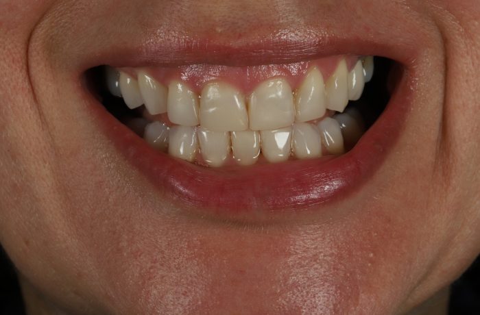 After - Cheadle Hulme Dental