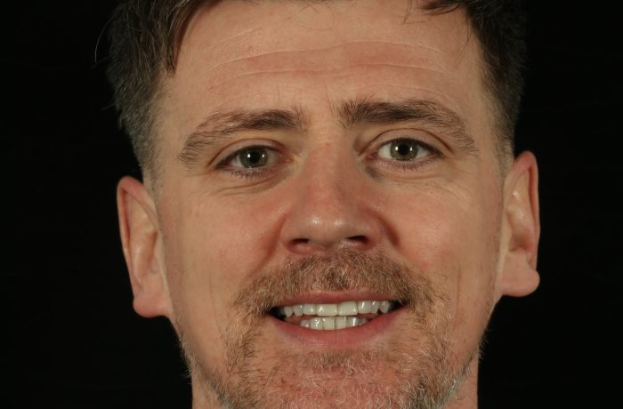After - Cheadle Hulme Dental
