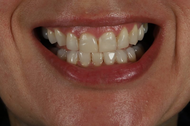 After - Cheadle Hulme Dental