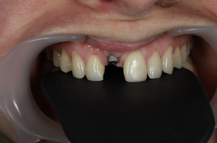 Before - Cheadle Hulme Dental