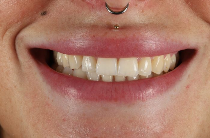 After - Cheadle Hulme Dental