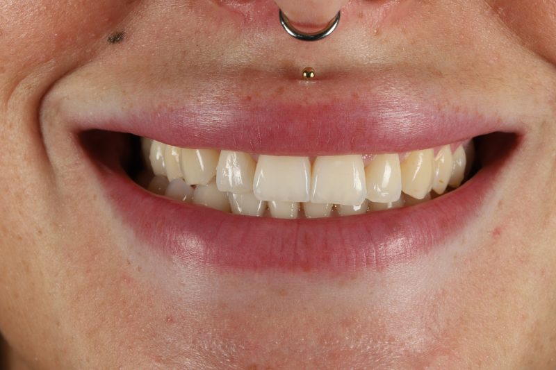 After - Cheadle Hulme Dental