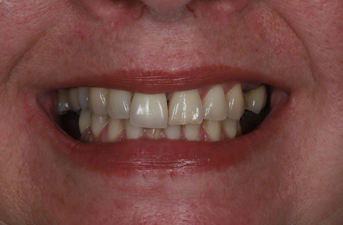 Before - Cheadle Hulme Dental