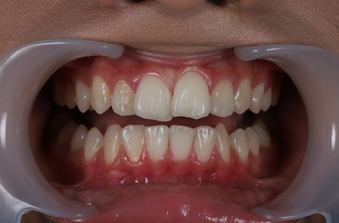 Before - Cheadle Hulme Dental