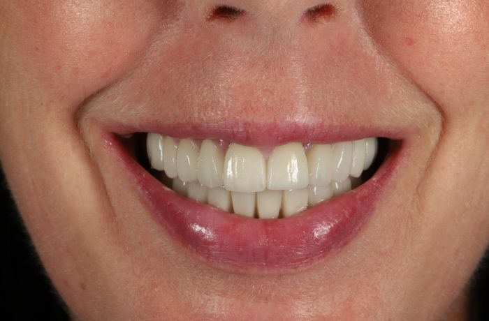 After - Cheadle Hulme Dental