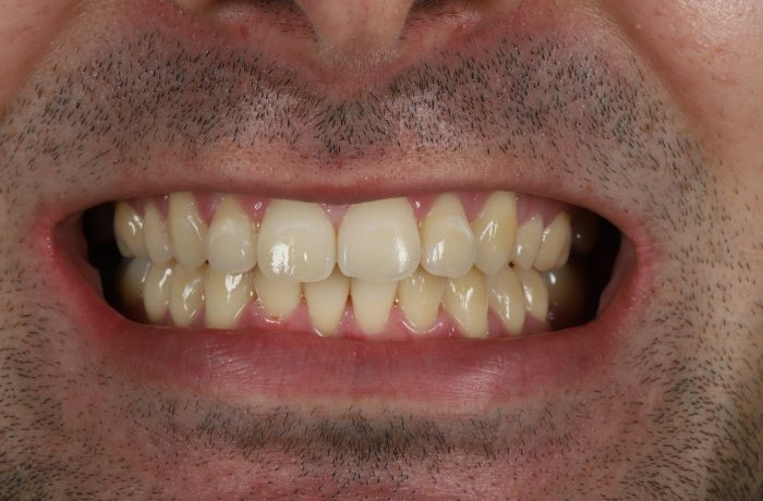 After - Cheadle Hulme Dental