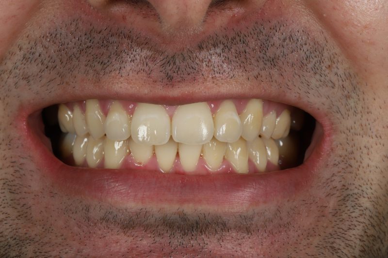 After - Cheadle Hulme Dental
