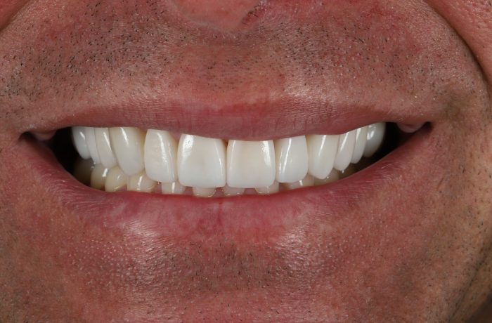 After - Cheadle Hulme Dental